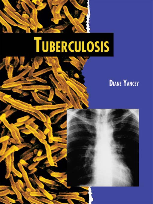 Title details for Tuberculosis by Diane Yancey - Available